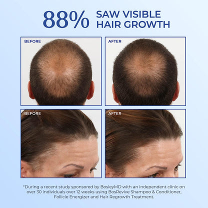 Bosley MD Revive Volumizing Conditioner for Non Color-Treated Hair, 10.1.oz - Reverse Generation Established in 2008